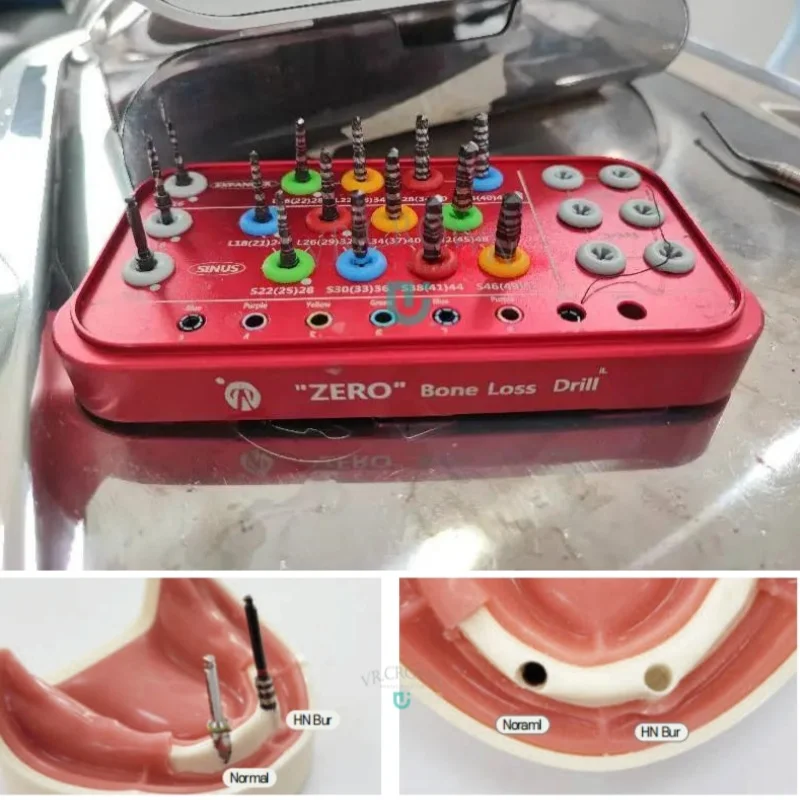 Имплантатные сверла