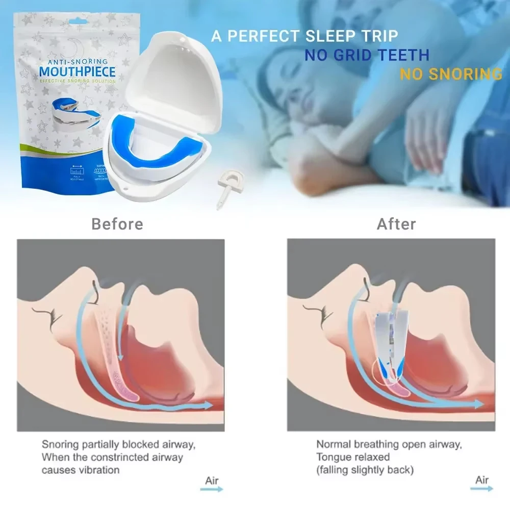 Anti Snore Mouth Guard Silicone Mouthpiece Stop Snoring Bruxism Sleeping Aid Apnea Guard Teeth Snoring Device Stop Snore Oral 3
