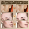 Pore Shrink Face Serum Remove Blackheads Acne Acidity Oil Control Repair Essence Moisturizing Nourish Pores Firming Facial Care 2