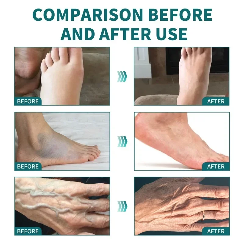Hand Foot Numbness Health Cream Repair Joint Sore Swelling Relieve Cramp Muscle Strain Bone Ache Care Tratamiento De Relajaci&oacute;n pain analgesic cream