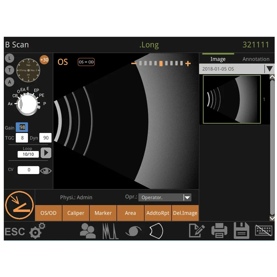 Description Picture 6 of itemAist Ophthalmic Ultrasound Scanner Optical A/B Scanner AB Scan Testing Equipment Ophthalmology Device Biometry Eye Scanner