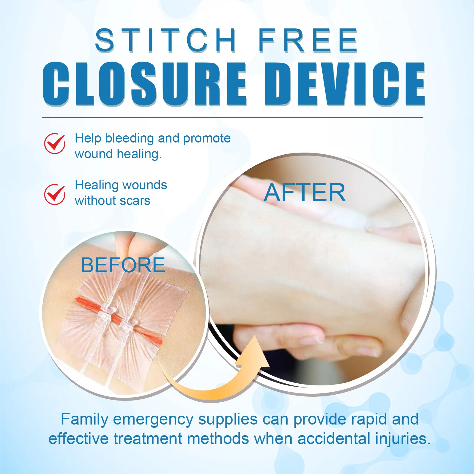 South Moon Portable Wound Closure Patch Painless Suture Zipper Band-Aid Repair Wounds Waterproof Stitch Free Hemostatic Sticker