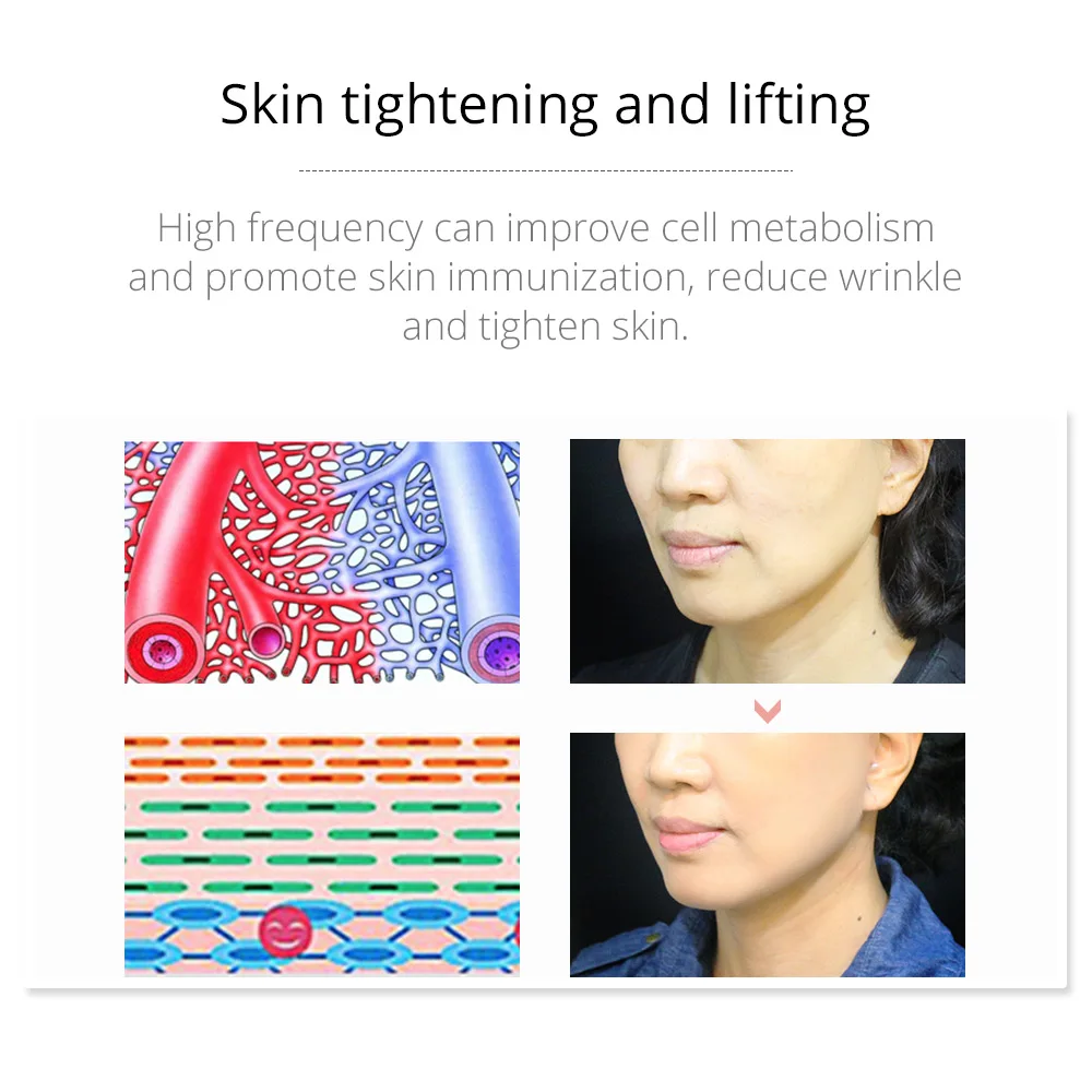 Darsonval Portable High Frequency Facial Machine Skin Therapy With 6 Neon & Argon Wands Remove Wrinkles Acne Facial Therapy Wand