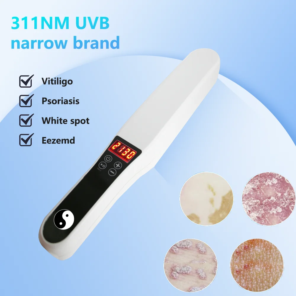 311nm UVB Treatment Instrument for Vitiligo and Psoriasis, Photon Therapy Light for Narrow Band Ultraviolet Phototherapy 2