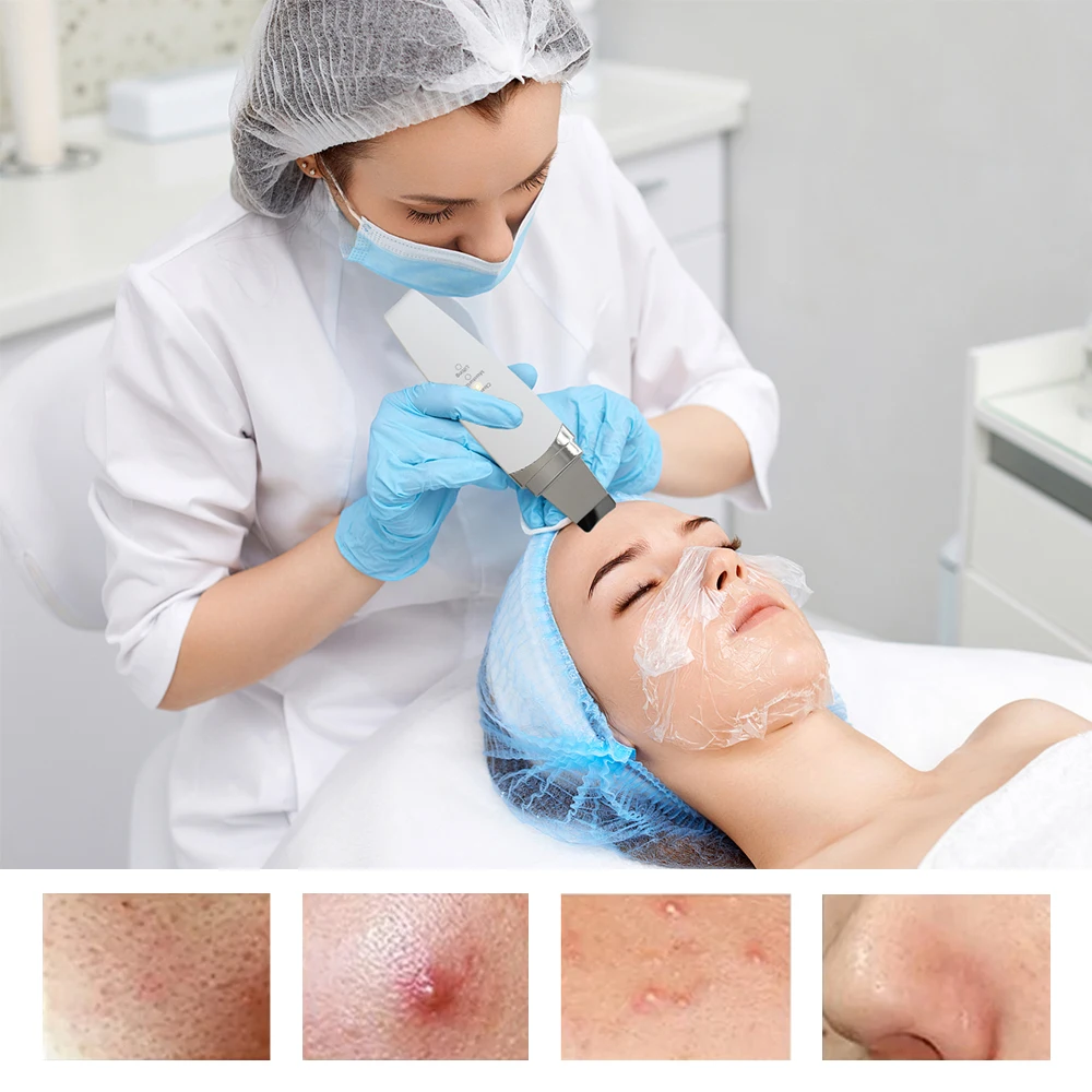 Facial Ultrasonic Skin Scrubber Spatula Blackhead Remover Deep Face Cleaner Lift Machine Pore Cleane