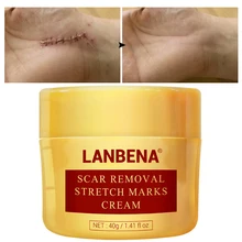 

Remove Scar Cream Moisturizing Brighten Remove Acne Scars Burn Surgical Marks Even Skin Tone Deep Nourishment Repair Body Care