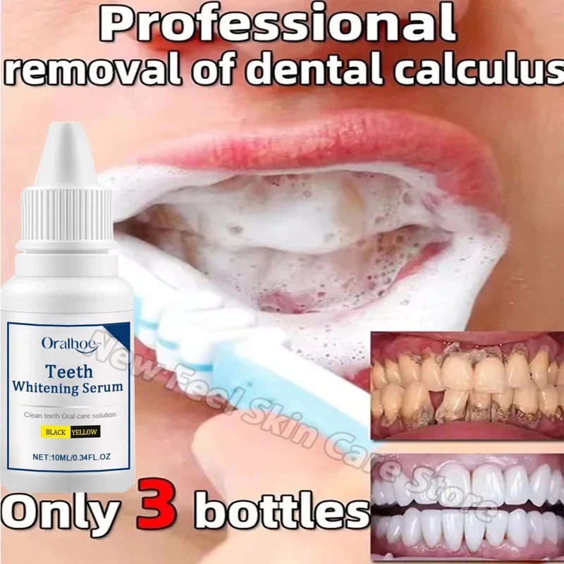 Teeth Whitening Serum Remove Plaque Stains Toothpaste Deep Cleaning Dental Oral Hygiene Tools Fresh Breath Tooth Care Products teeth whitening product teeth whitening essence