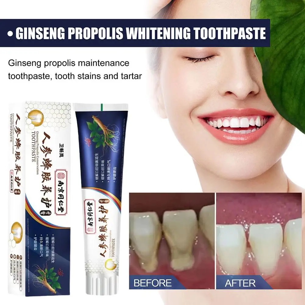 

Tooth Decay Whitening Toothpaste To Tooth Stains To Whitening Bad Yellow Quick-acting To Breath Remove Oral Breath Fresh Y9K2