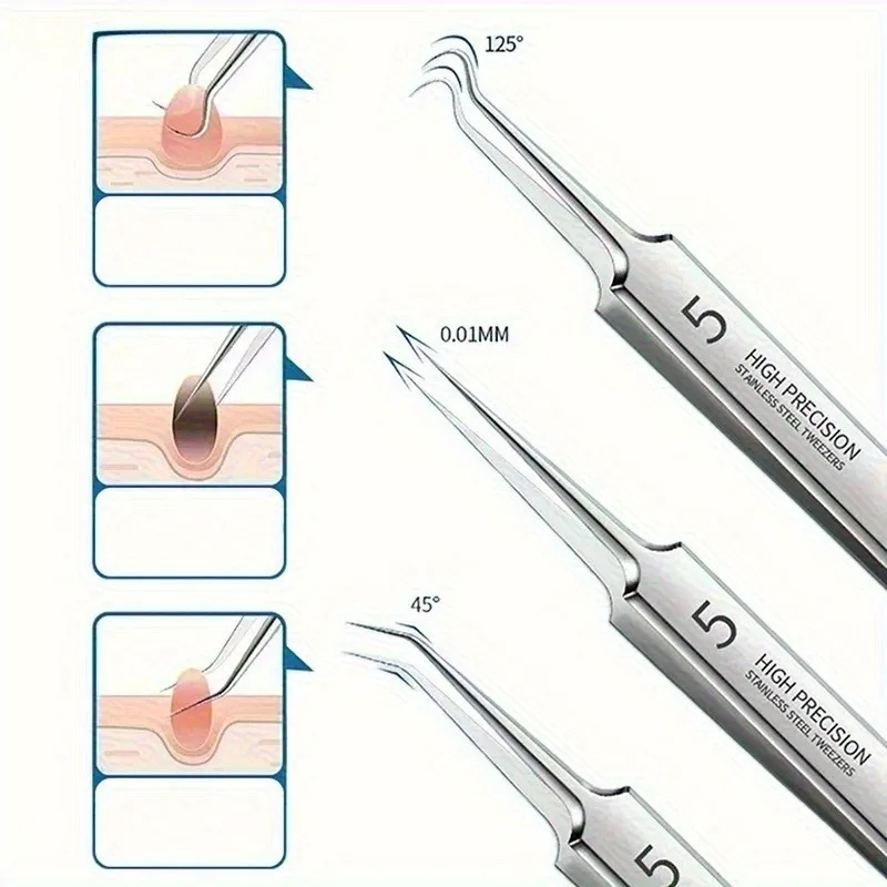 Blackhead Clip Pimples Tweezer Blackhead Remover Stainless Steel Cell Clip Beauty Product Acne Needle Skin Cleanning Tool