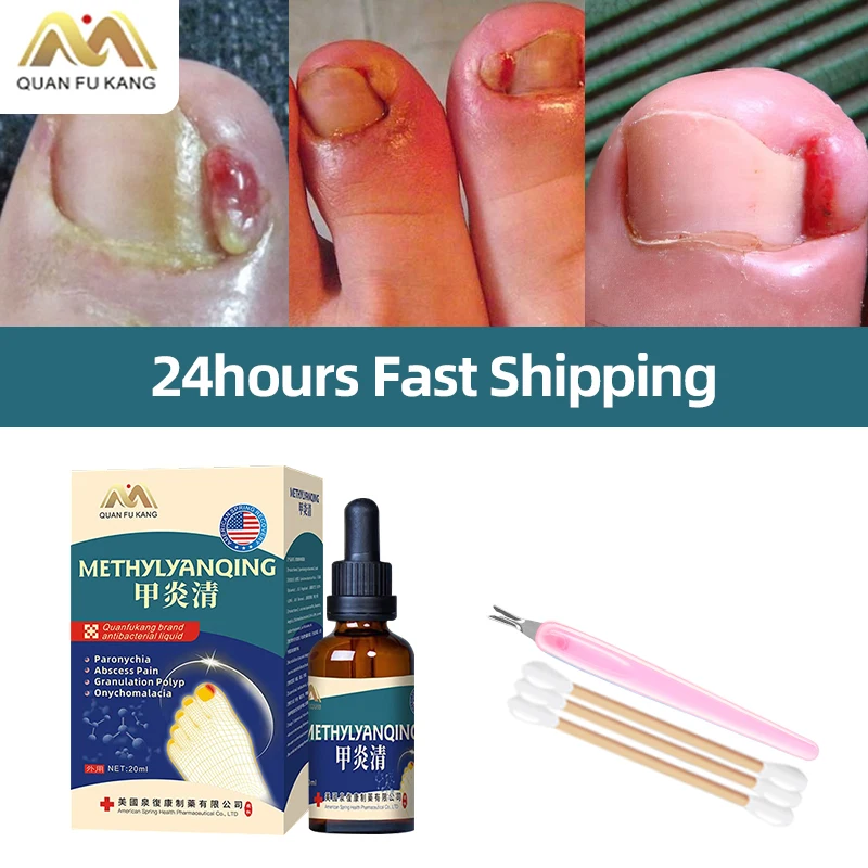 

Paronychia Treatment Liquid Nail Fungus Cleaner Nail Ingrown Correction Onychomycosis Toenail Fungal Care Tools American Formula
