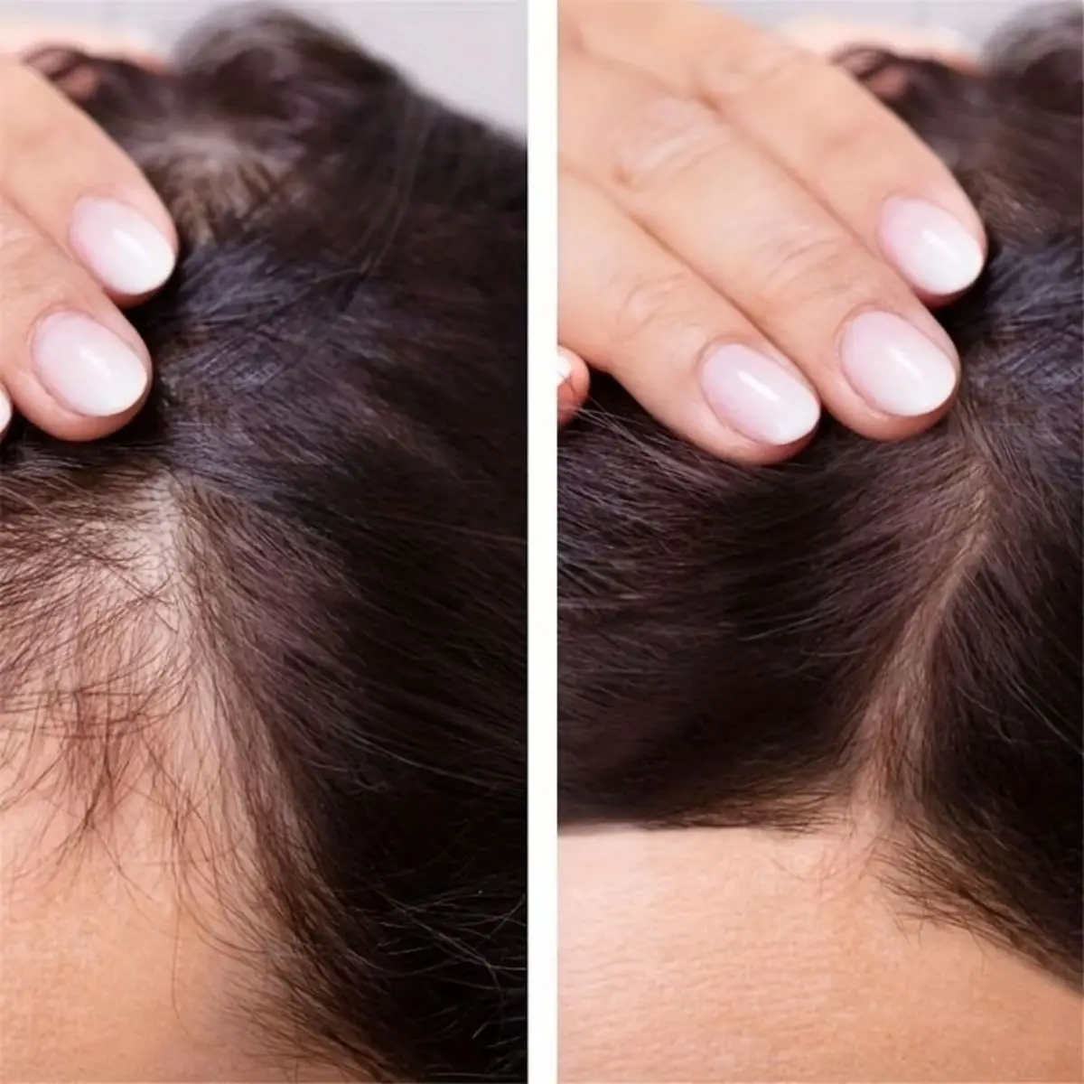 Hair Growth Serum for Men Essential Oil Hair Repair Furcation Protection Anti-hair Loss Beard