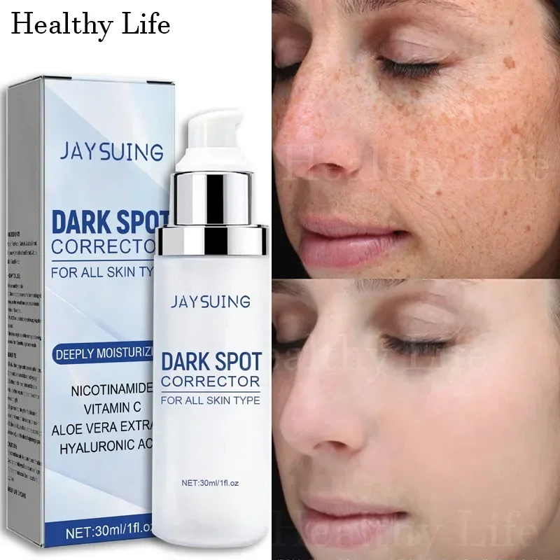 

Nicotinamide Whitening Freckle Removing Cream Effectively Remove Melasma Corrector Fade Dark Spot Serum Lightening Pigmentation