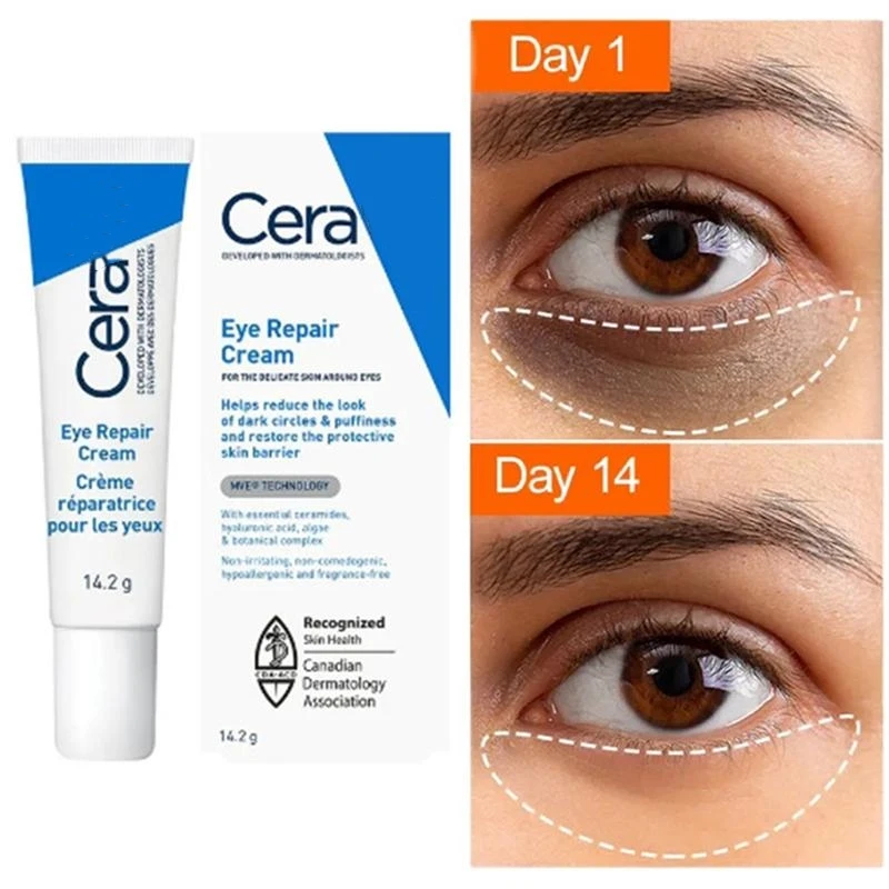 S97bb2377d1724655a1206c175cc7f7f3F Retinol Eye Cream Remover Dark Circles Eye Bags Anti-Wrinkle Anti-Puffiness Reduces Fine Lines Moisturizing Eye Skin Care