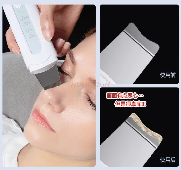 Ultrasonic peeling machine suction blackhead pore cleaner facial beauty instrument