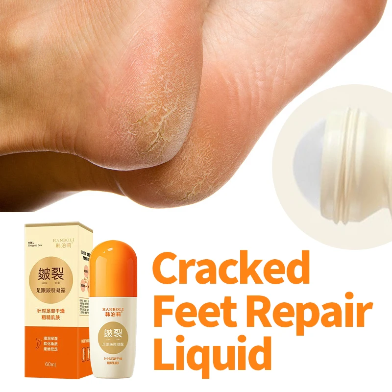 

Anti Crack Foot Cream Drying Cracked Feet Repair Hand Heel Chapped Dead Skin Removal Dew Moisturizing Peeling Care Foot Mask