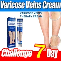 Ointment for Varicose Veins Eliminate Vasculitis Phlebitis to Relieve Spider Leg Pain Treatment Herbal cream 1