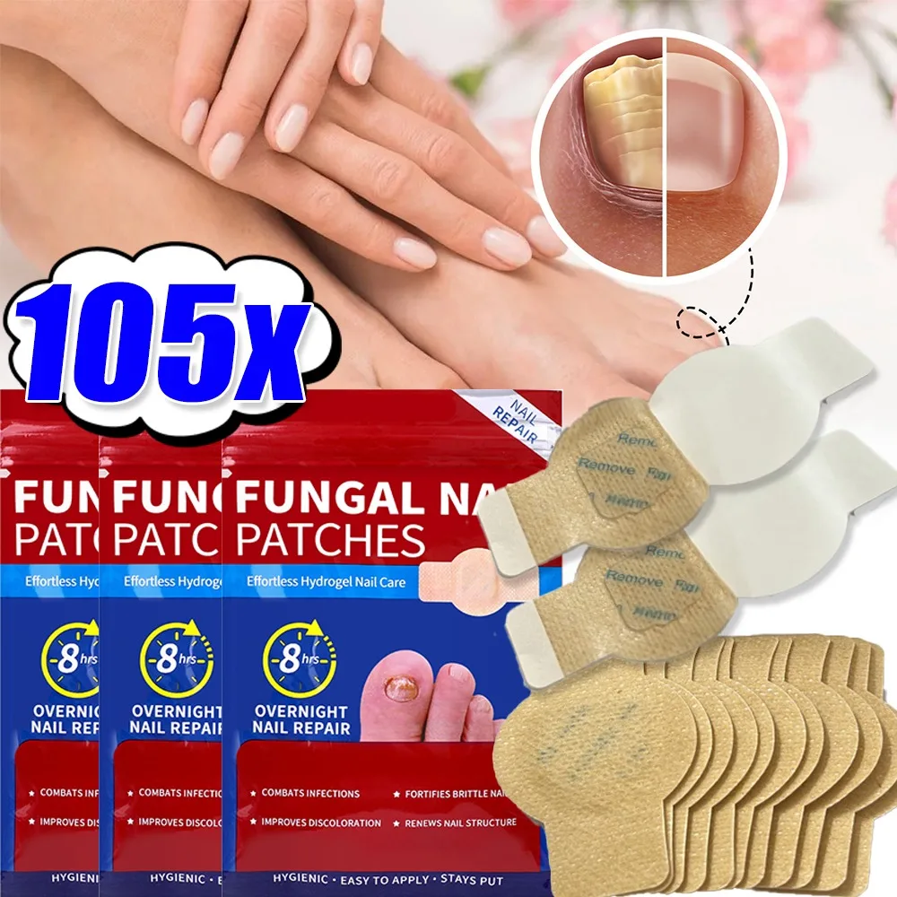 Nail Repair Patches Toenail Fungus Patch Sticky Toenail Care Nail Ingrown Correction Sticker Paronychia Disposable Toe Patch Nail Repair Patches Toenail Fungus Patch Sticky Toenail Care Nail Ingrown Correction Sticker Paronychia Disposable Toe Patch