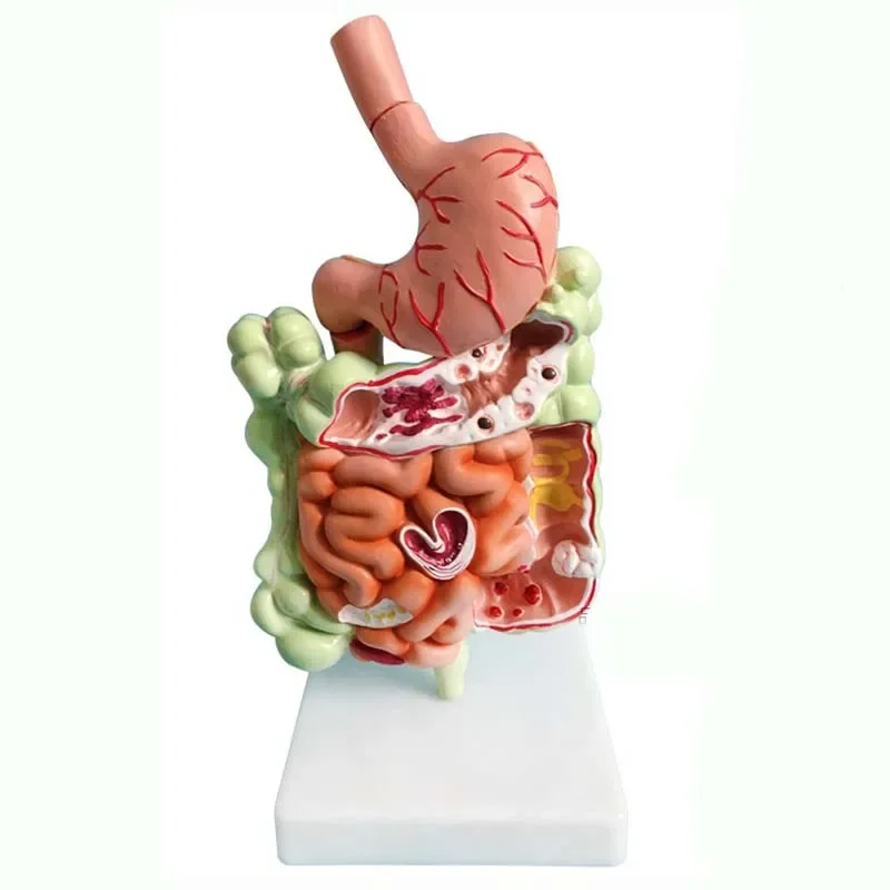 

Human digestive system stomach anatomy large intestine cecum rectum duodenum human internal organs structure medical model