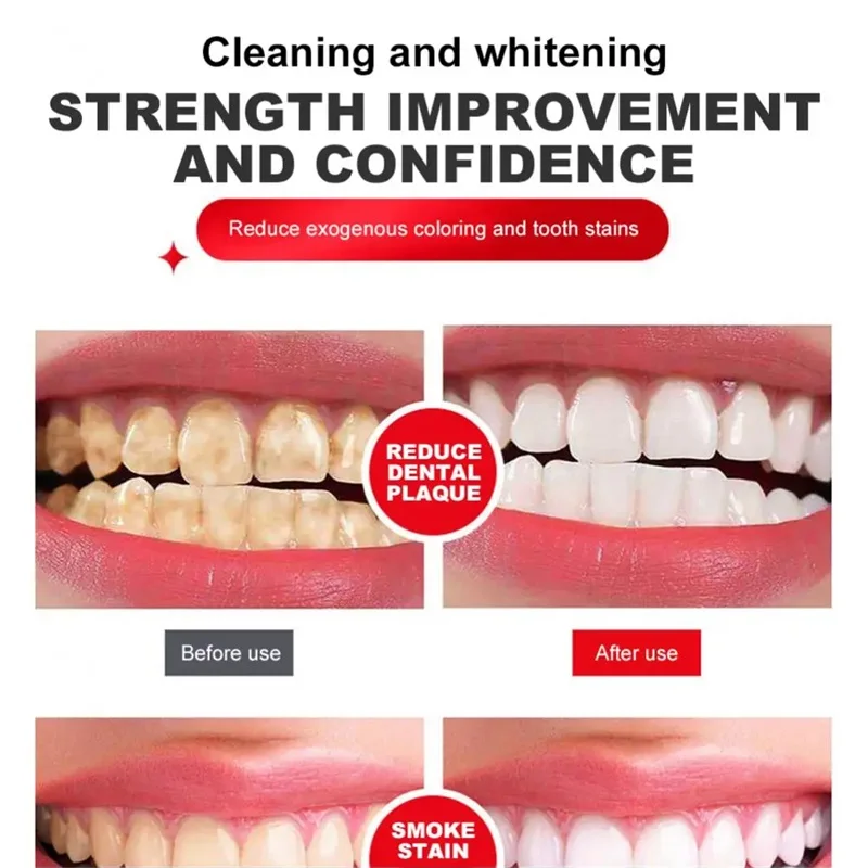 Teeth Whitening Product Teeth Health Product Probiotic Whitening Toothpaste Brightening Stain Removing 120g SP-4 Fresh Breath Enzyme Toothpaste Whitening Teeth