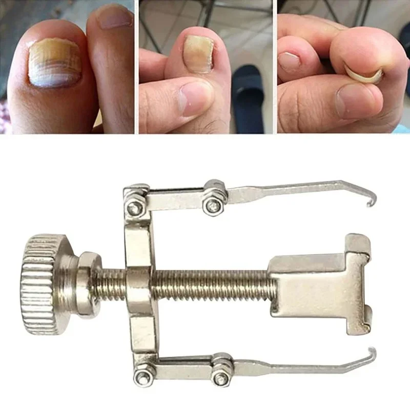 Ingrown Armor Toe Nail Correction Pedicure Fixer Straightener Clippers Recover Set Clamp Scissors Device Tool manicure pedicure kit manicure set manicure sets manicure nail clipper set nail clippers kit toe nail corrector