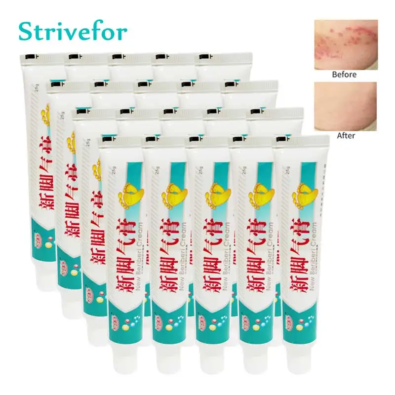 20pc Ointment For Eczema Dermatitis Psoriasis Anti Fungal Itching