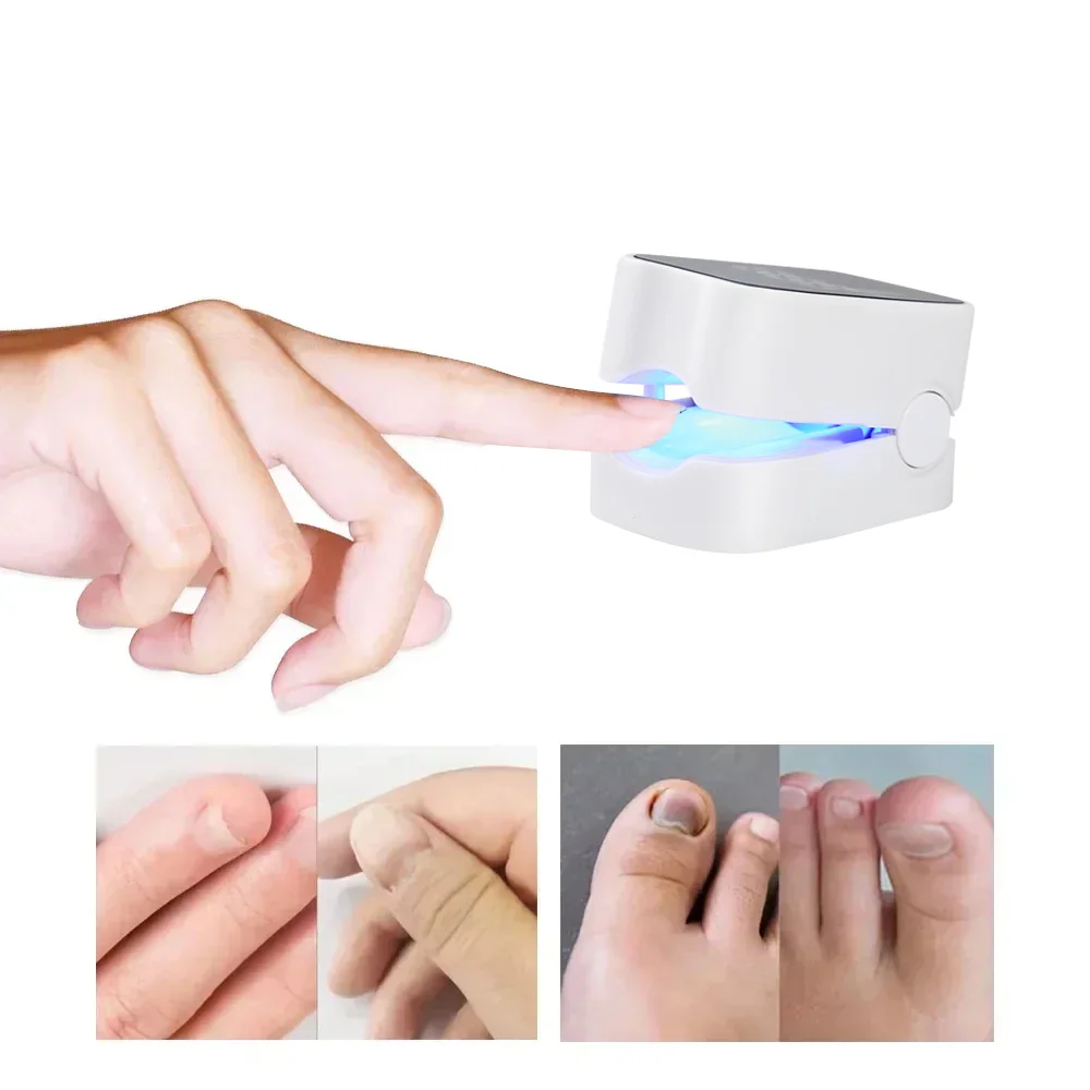 Nail Fungus Laser Treatment Device USB Charging Fingernails Toenails Onychomycosis Therapy Cure Machine Unisex Foot Care Tools