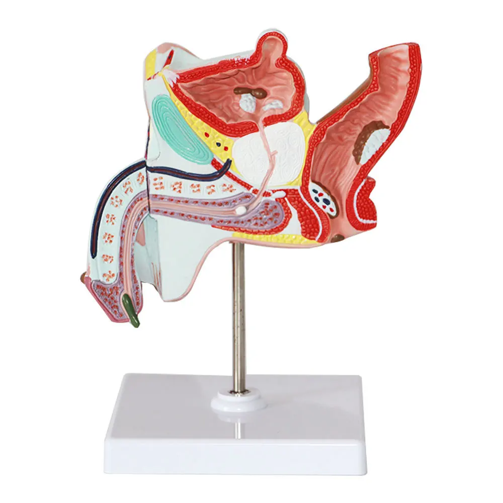 Male anatomical model of internal and external organs Male gonorrhea model Medical teaching equipment