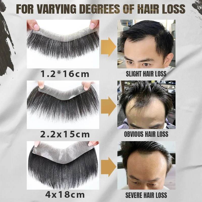 Men’s Hairline Toupee Wig V Loop Front Hairline Forehead Toupee For Men