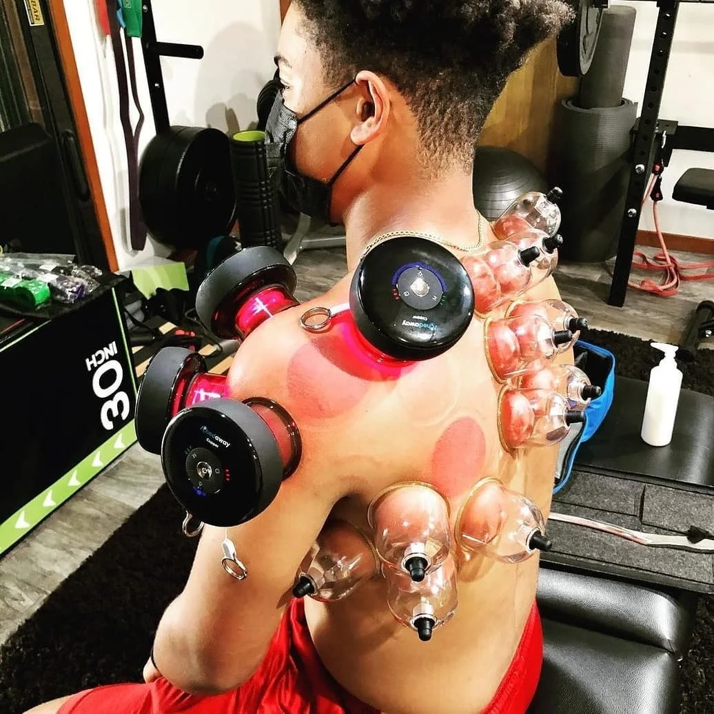 Achedaway Cuppers Cupping Physical Therapy Devices New Cupping physiotherapy tools Physiotherapy Equipment 4