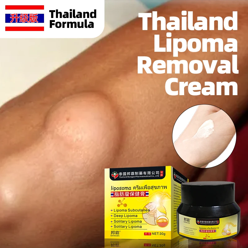 

Lipoma Removal Cream Fat Mass Cellulite Fibroma Remover Ointment Fat Lump Lipomas Cyst Treatment Medicine Thailand Formula