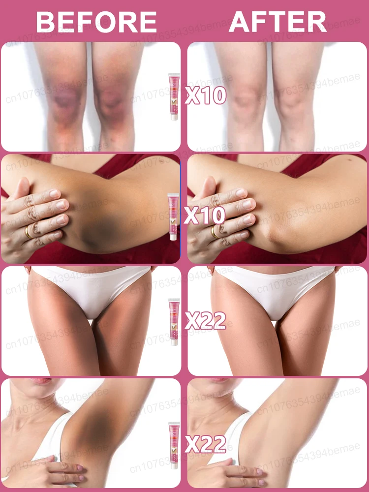 Crème blanchissante pour le visage, élimine les taches de rousseur et les taches foncées, éclaircit la pigmentation de la mélani 6