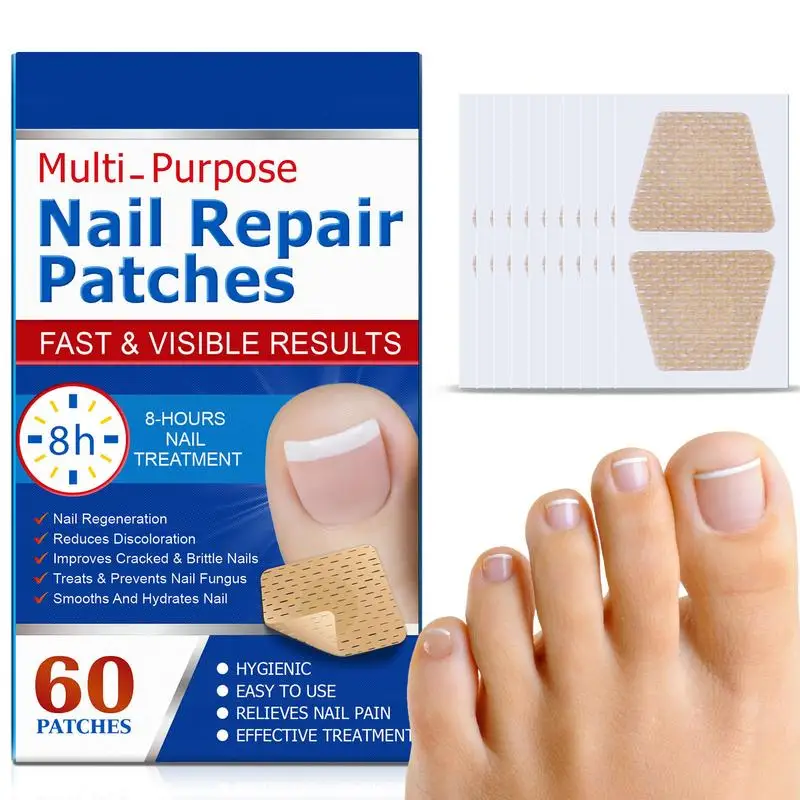 60pcs/set Nail Repair Patches Non Irritating Nail Ingrowning Toenail Corrector Stickers Helps With Cracked Nails 2