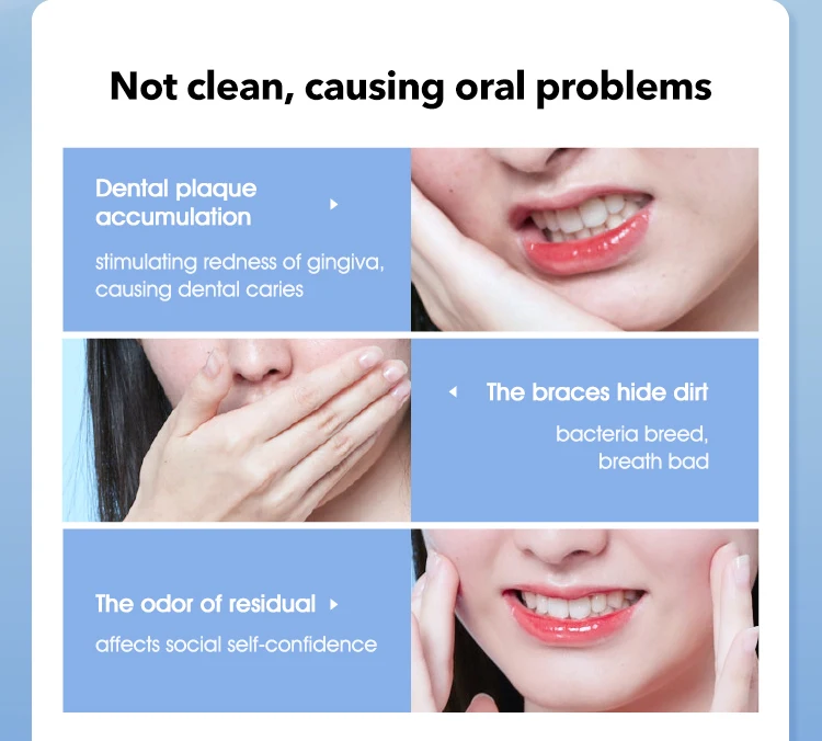 Xiaomi SOOCAS W3 Pro Water Flosser Teeth 4 Type Nozzle Cleaner description image 4
