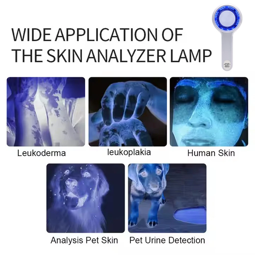 NEW Woods Lamp Skin Analyzer For Skin UV Magnifying For Beauty Facial Testing Wood Lamp Light Skin Analysis Detection Skin Care