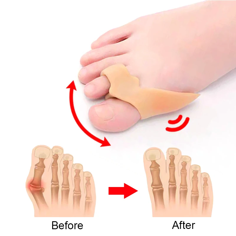 2Pcs=1Pair Protect Toe Separator Bunion Hallux Valgus Corrector Thumb Correction Material Soft Straightener Foot Care Tool H066