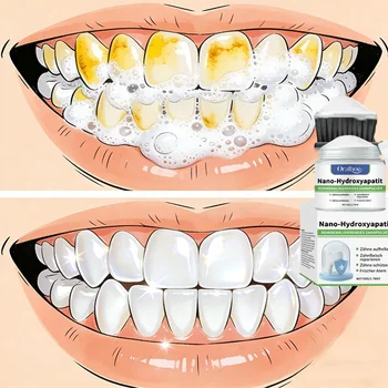 Polvere Sbiancante per Denti L, Pulizia Profonda per Uomini e Donne, Rimozione di Macchie Gialle, Igiene Orale, Alito Fresco