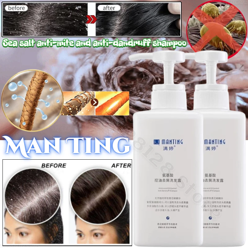 Manting Sea Salt Removes Mites Controls Oil Removes Dandruff Relieves Itching Fluffy Shampoo Deep Cleansing Scalp Shampoo 250ml