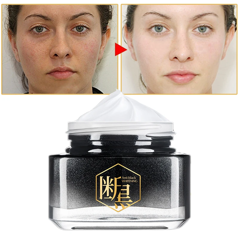 Niacinamide Face Cream Whitening Nourishing Repairing Fading Spots Removing Pigment Firming Lifting Skin Beauty Skin Care 50g