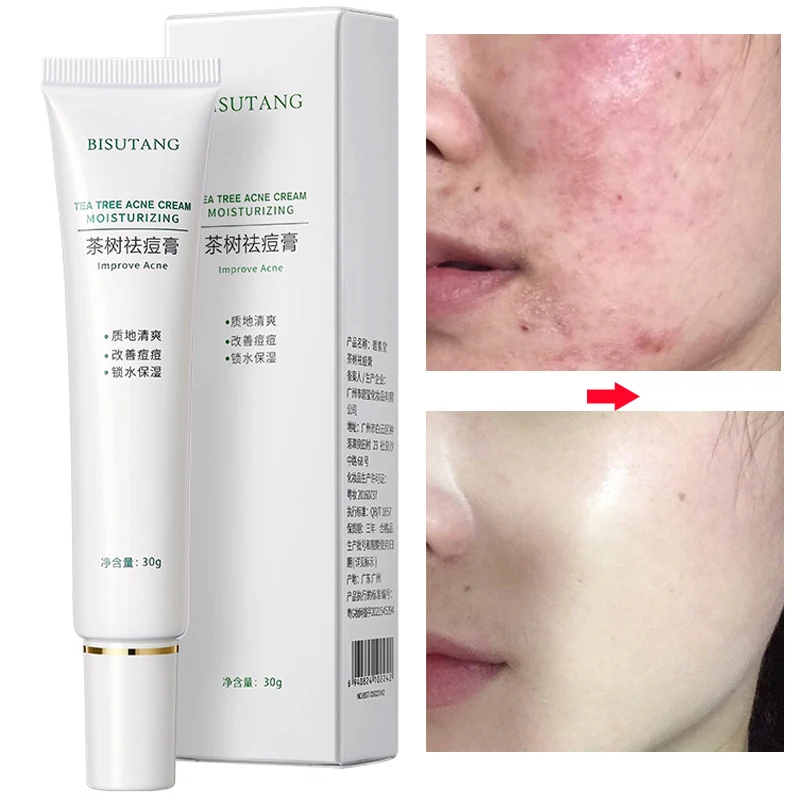 

Herbal Acne Removal Face Cream Oil Control Anti-Acne Gel Treatment Acne Mark Skin Care Whitening Eliminate Pimples Facial Cream