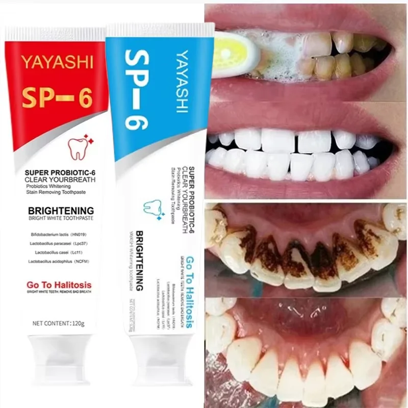 120g Probiotic Toothpaste Whitening Tooth Remove Plaque Stains Teeth Whitener Oral Hygiene Clean Fresh Breath Dental teeth whitening essence,teeth whitening product