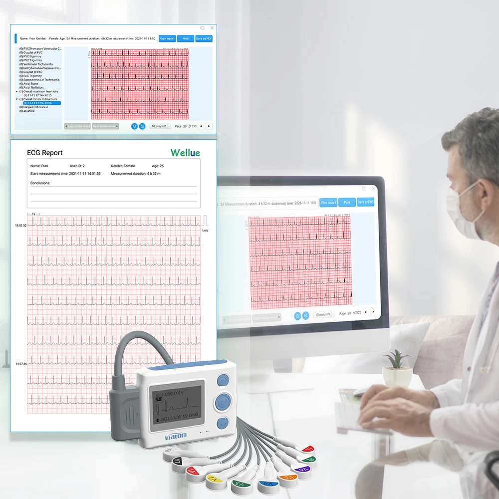 12 lead Holter monitor monitor recorder 24-hour continuous monitoring ECG and heart rate device ECG electrode data stora