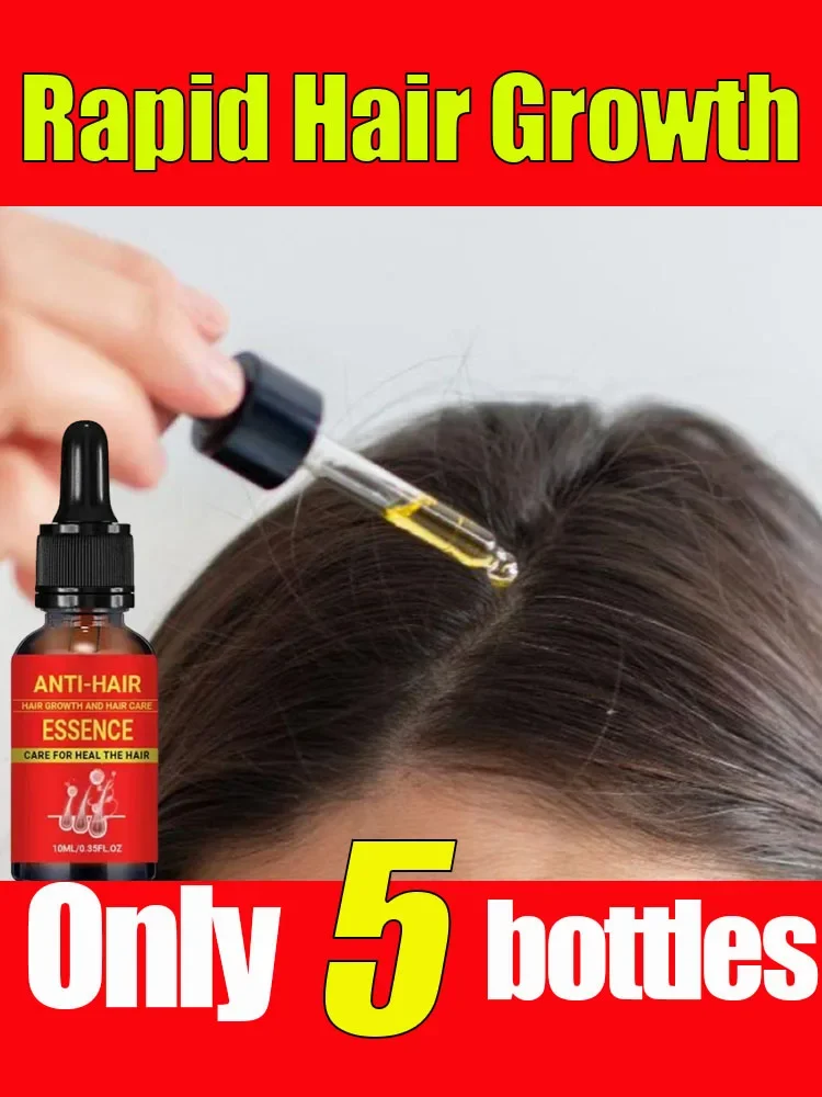 

Fasr Hair Growth Oil Hair Loss Treatment Rapid Effective Baldness Repair Hereditary Postpartum Hair Loss