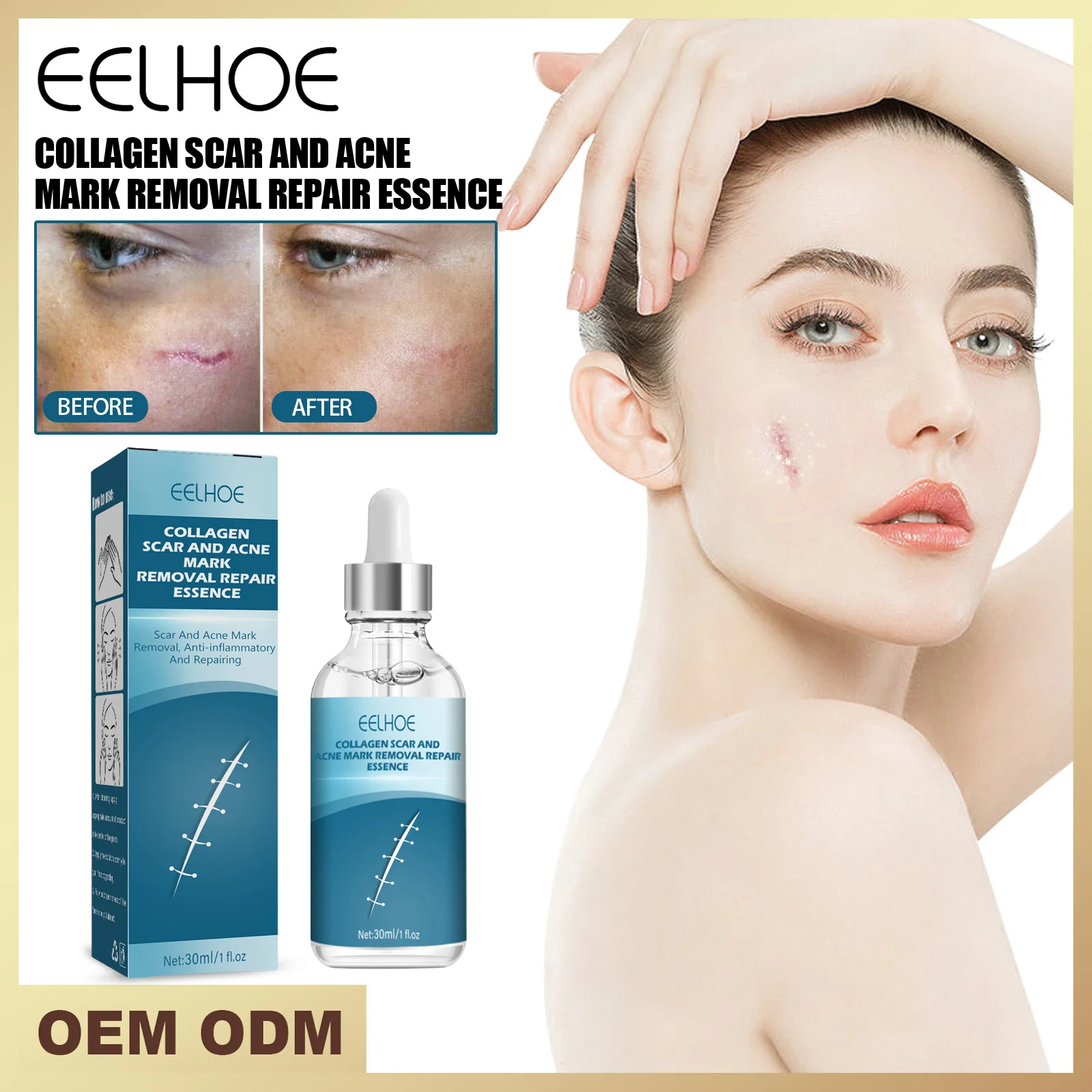 

Scar Repair Essence Lightening Surgery Scar Caesarean Section Scar Repair Smoothing Moisturizing Skin Essence