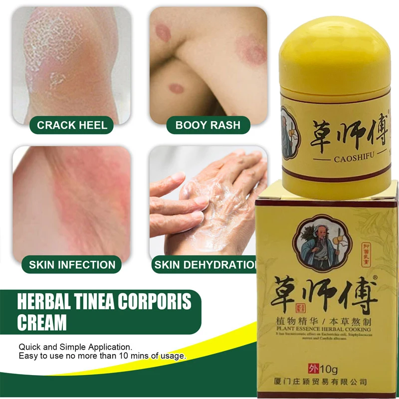 Skin Care Ointment 10g CaoShiFu Eczema Treatment Ointment Antibacterial Psoriasis Cream Anti-Itching Antipruritic Skin Care Herbal Plaster