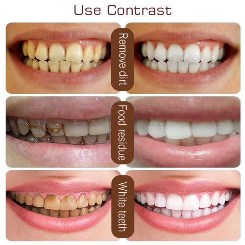 Teeth Whitening Product Teeth Whitening Essence Teeth Health Product Cleaning Teeth Whitening Toothpaste
