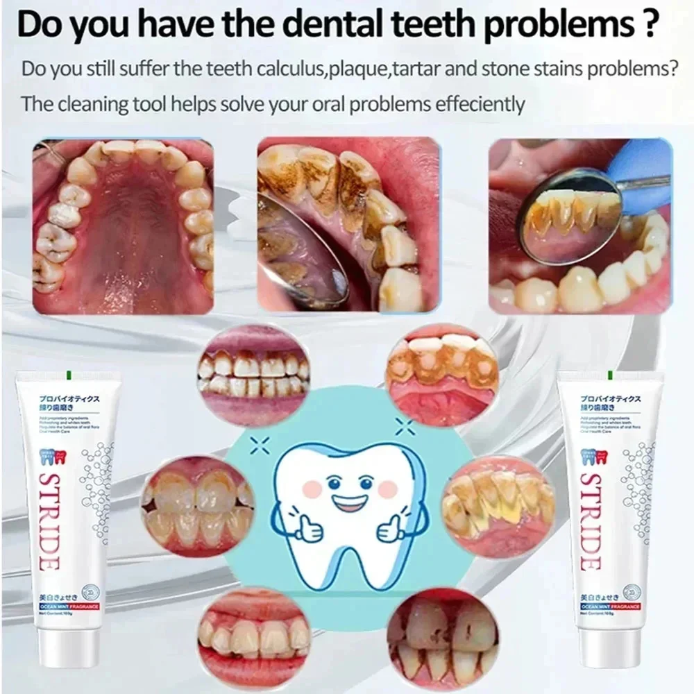 Dental Calculus Remover Teeth Whitening Toothpaste Oral Hygiene Cleaning Remove Plaque Stains Prevent Periodontitis Fresh Breath