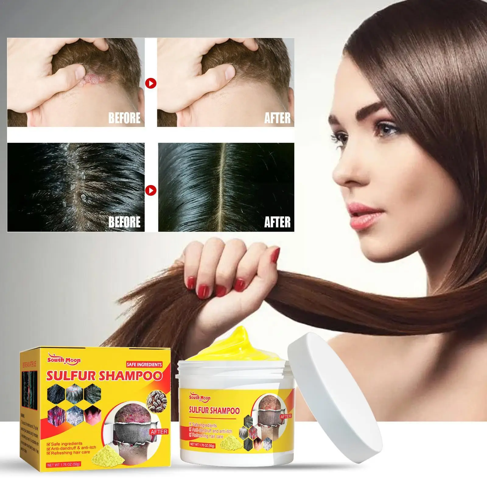 50g Sulfur Shampoo Remove Lice Mites Dandruff Itching Oil Cleaning