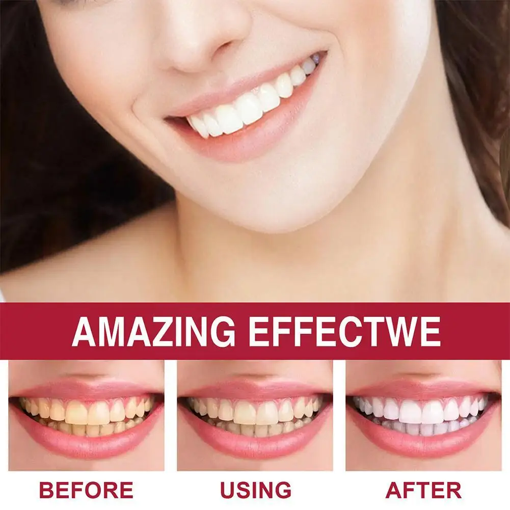 Sp4 Teeth Whitening Toothpaste Tooth Correction Whitener Original 120g Teeth Whitening Purple Toothpaste Non-invas R8q5