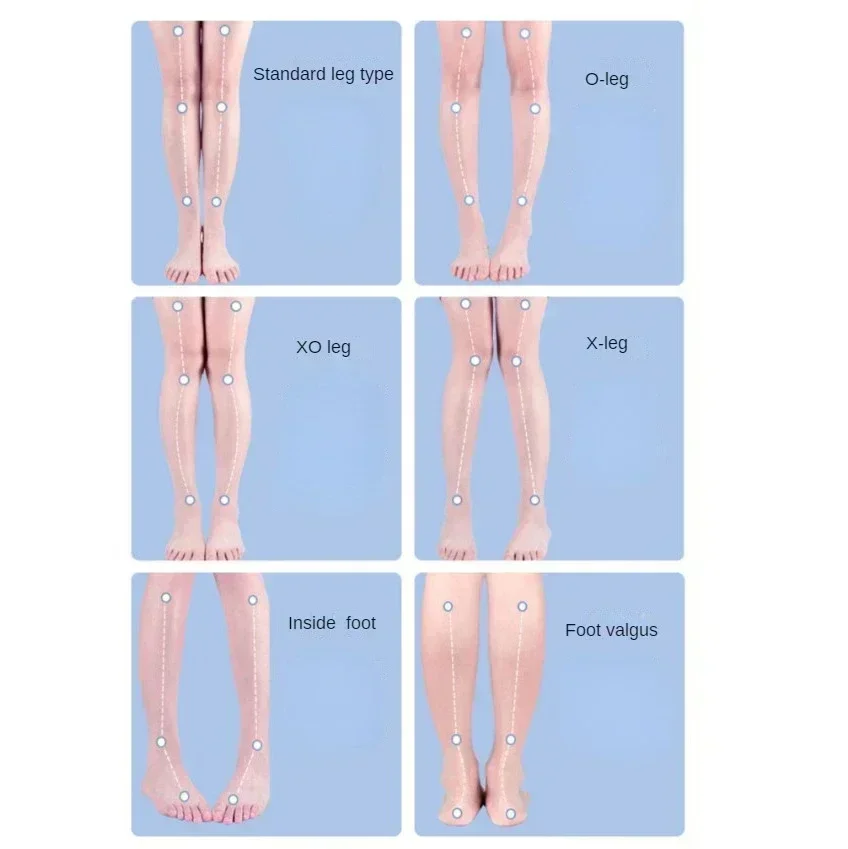 Orthotic insoles shoe insoles orthopedic insoles 1Pair O/X-Leg orthopedic insoles arch support for flat feet adults kids