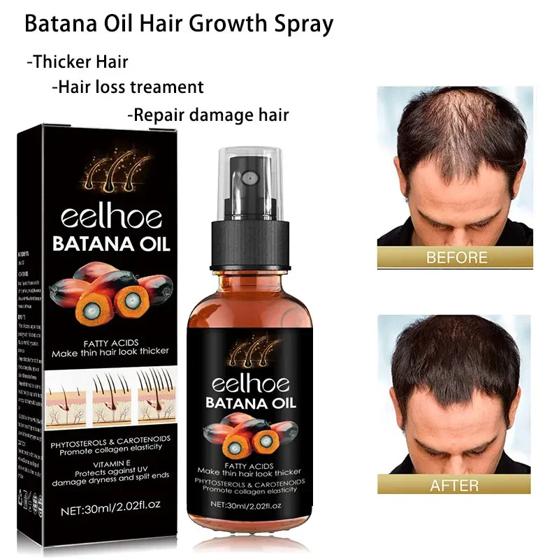 African Batana Oil Hair Growth Spray Repair Baldness Hereditary Hair Loss Treatment moisturize the scalp aceite para el cabello